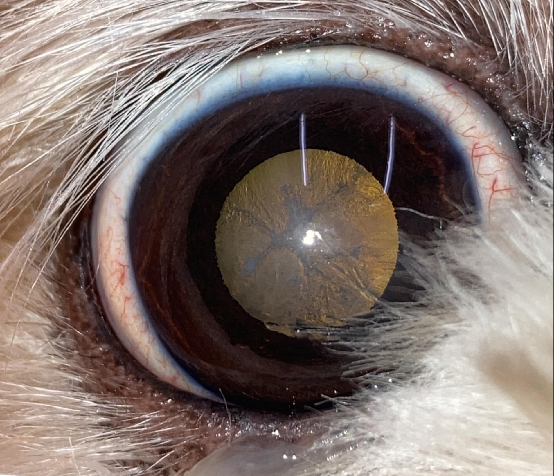 白内障とは、水晶体が白濁して視界がぼやける眼の疾患です