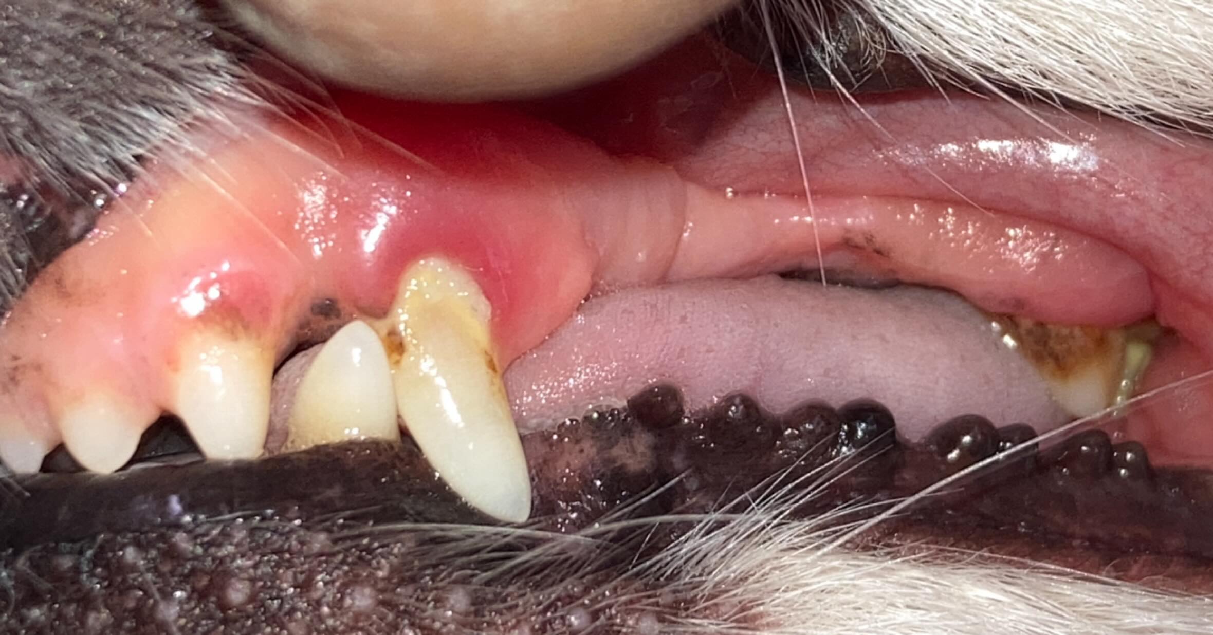 歯肉が赤いと感じられる場合、特に歯の根元に沿って一箇所だけ赤みが強い場合は、全体が綺麗に見えていても歯周病の可能性を考慮する必要があります