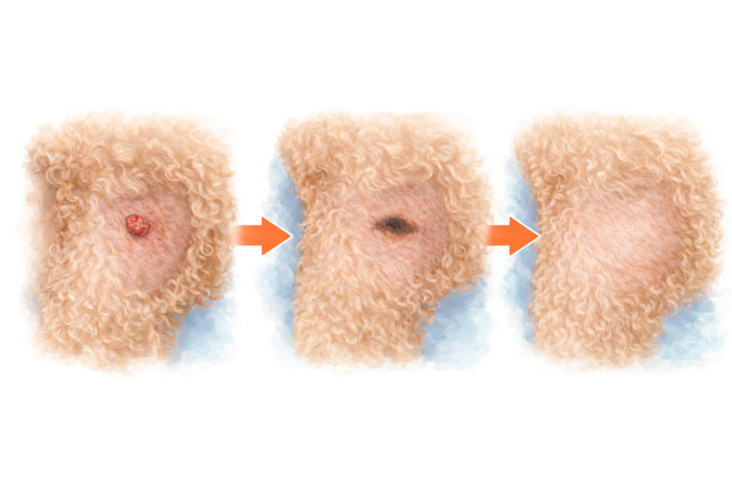 皮膚にしこりが見つかると、多くの方が不安を感じるものです