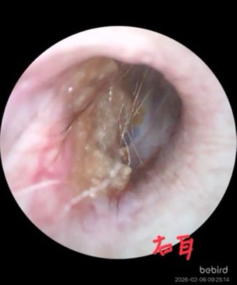 外耳炎は多くの犬が経験する耳の疾患で、しばしば長引くことがあります