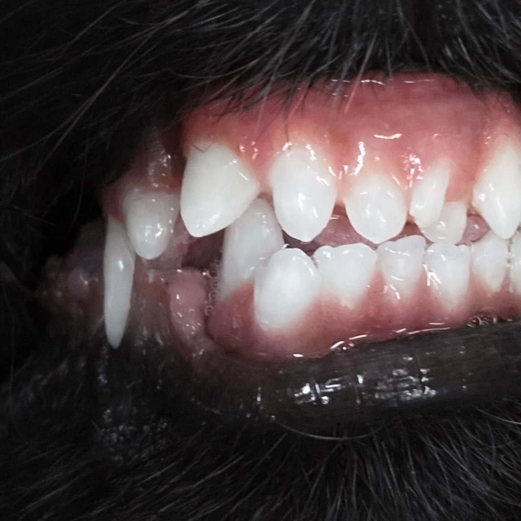 乳歯が通常よりも長く口腔内に留まることは、後に成長する永久歯の位置に影響を及ぼす可能性があります