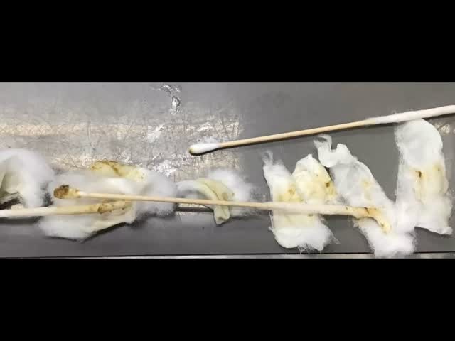 涼しくなったのに外耳炎が増えていますの画像リンク